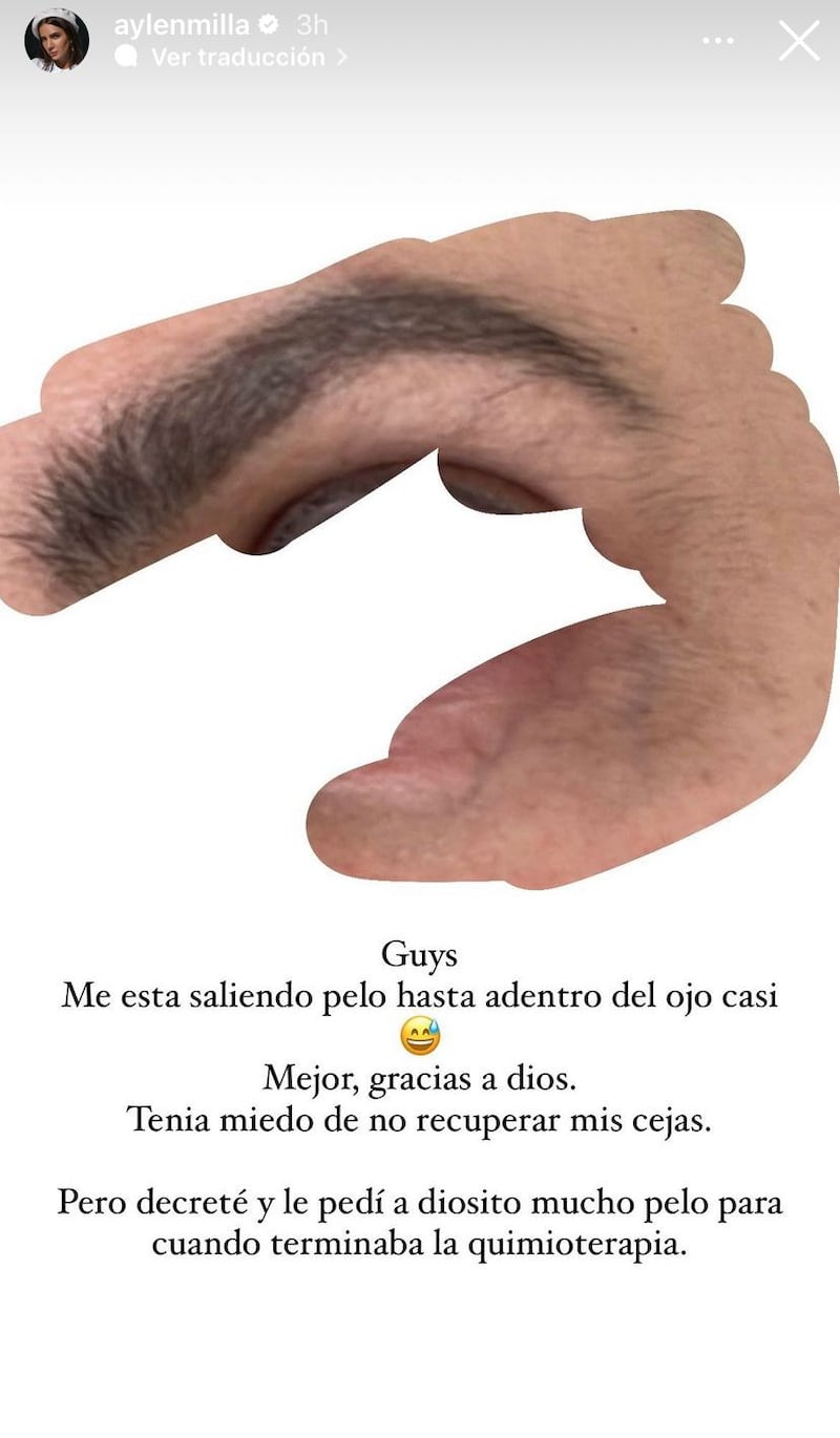 Aylén mostró los primeros avances de su recuperación capilar. Captura de Instagram