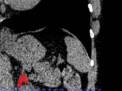 Por primera vez es posible ‘ver’ el estrés crónico gracias a la IA