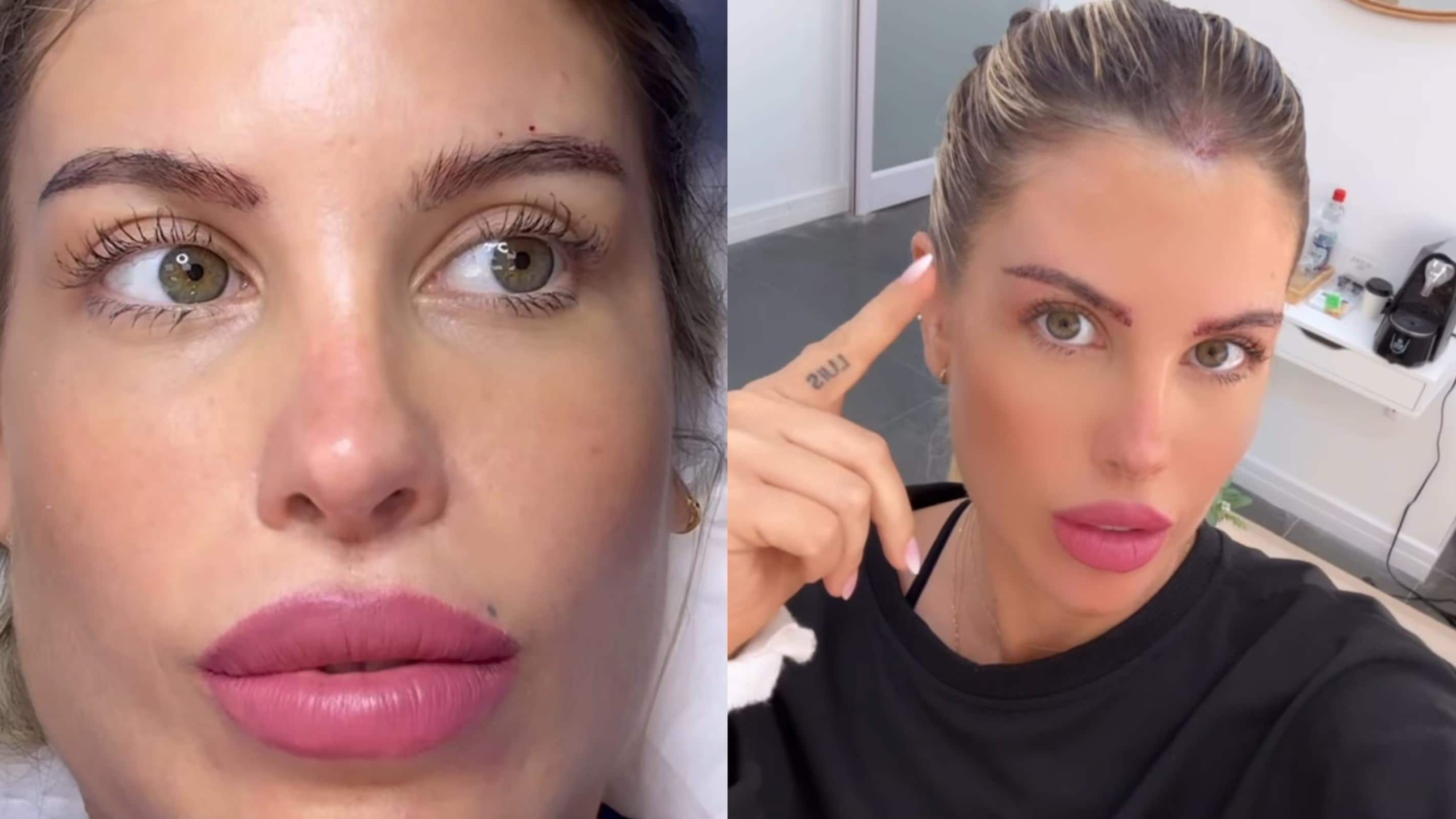 Coté López luego de someterse a un procedimiento estético