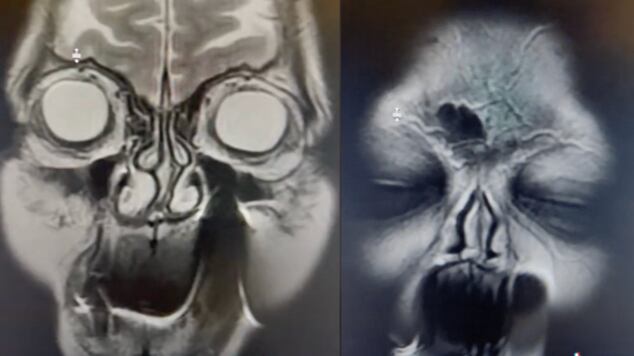 Radiología de mujer se hizo viral