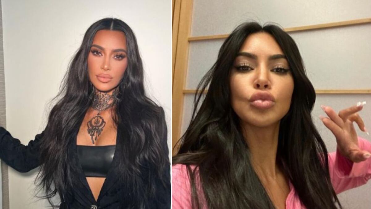 ¿Tiene cura? Kim Kardashian muestra el avance de su psoriasis y sensibiliza sobre esta enfermedad