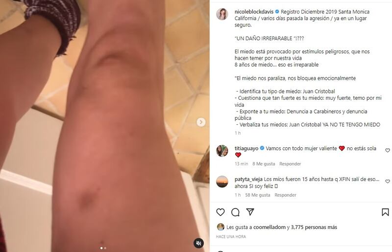 Nicole Block mostró este jueves nuevas evidencias del maltrato sufrido por su marido.