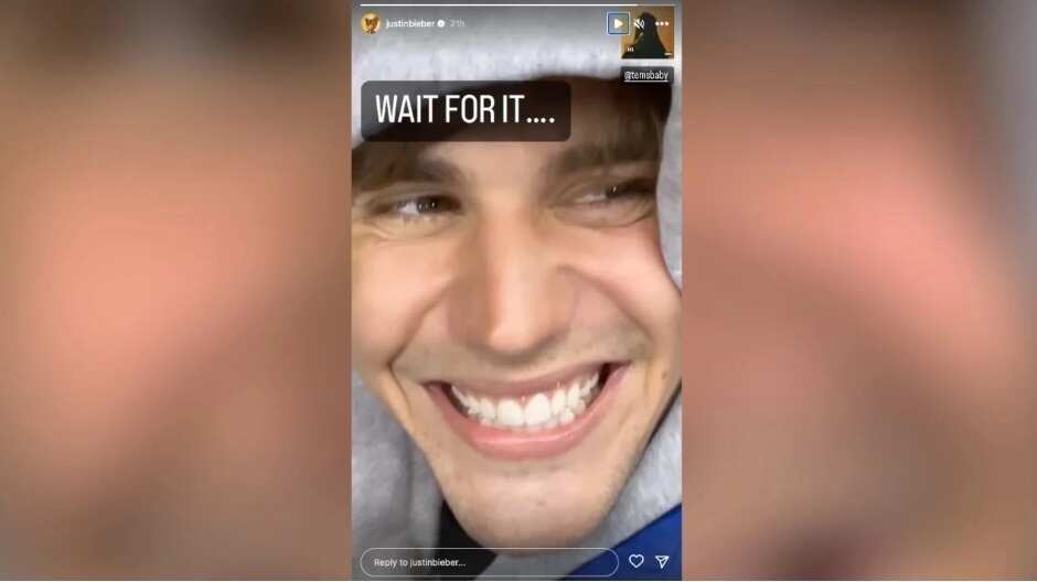 Justin Bieber mostró en sus redes sociales una gran mejoría facial.
