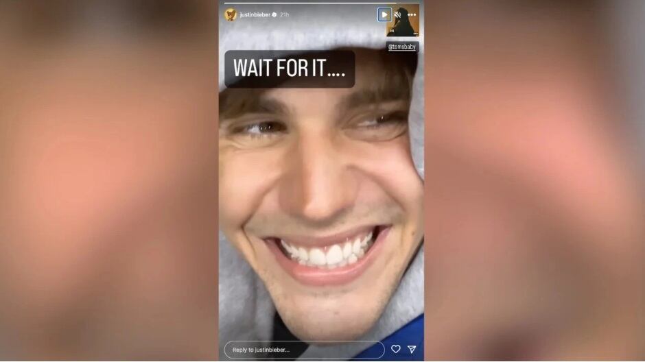 Justin Bieber mostró en sus redes sociales una gran mejoría facial.