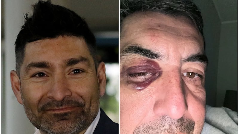 “Ellos eran como 40 y nosotros éramos 10... nos sacaron la cresta”: involucran a Gamadiel García en violenta pelea