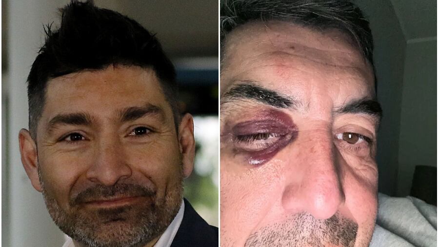 Gamadiel García y el afectado Víctor Sanhueza