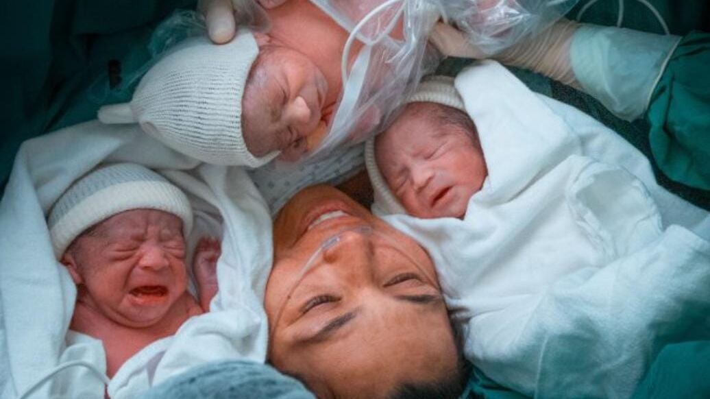 Trillizos gemelares nacidos en el Hospital de Antofagasta