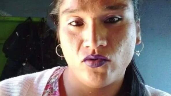 Mujer apareció quemada