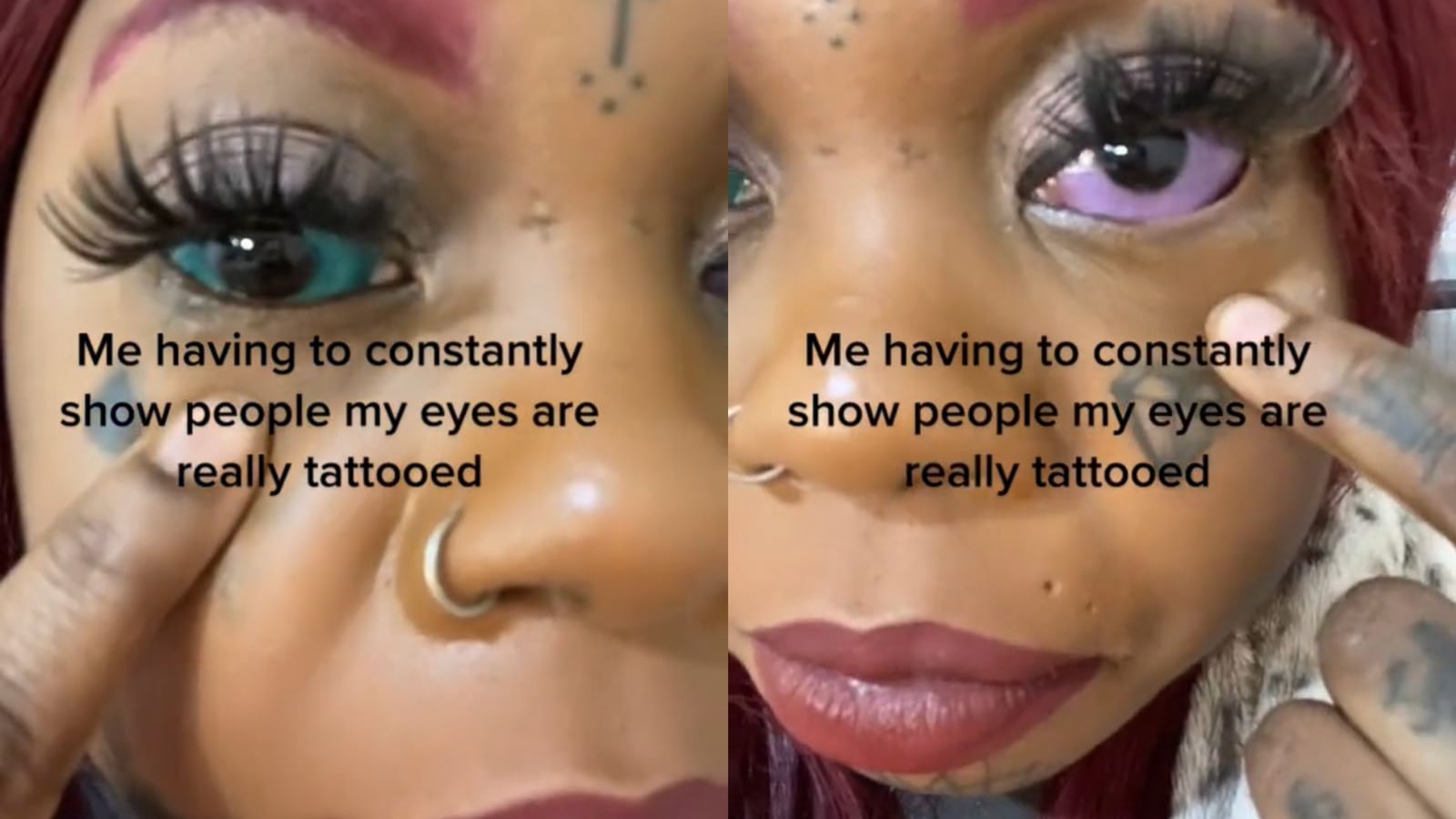 Mujer se tatuó de color los ojos y tiene riesgo de quedar ciega.