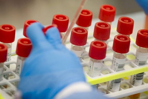 Variante brasileña de covid ya está en Biobío: autoridad se dio cuenta días después
