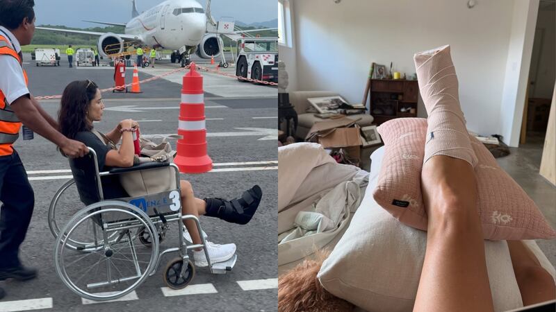 “La fractura era más seria de lo que parecía”: Leonor Varela comienza su recuperación tras accidente sufrido durante sus vacaciones en México