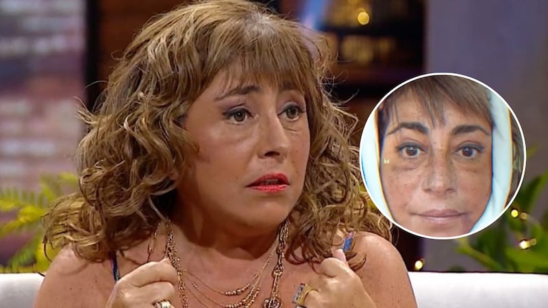 “Me sacó la cara y me la volvió a poner”: Helhue Sukni contó detalles de la impactante cirugía facial que se realizó