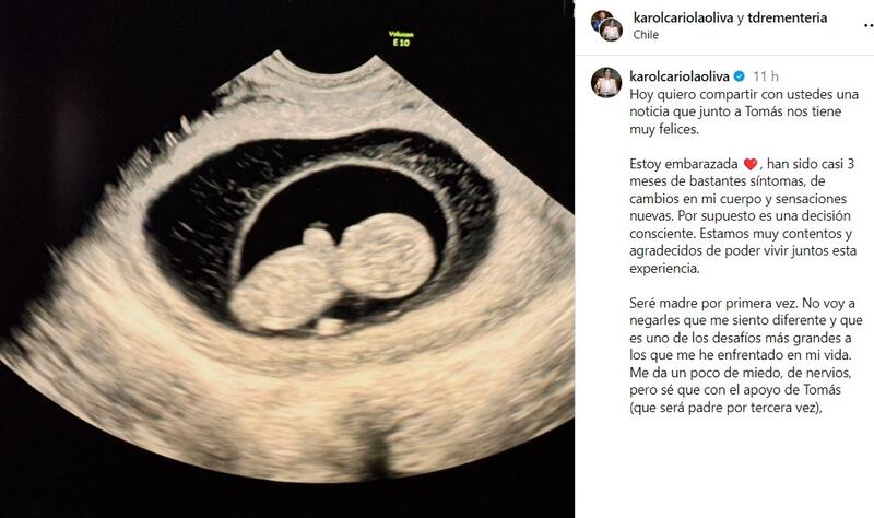 La diputada comunista confirmó este martes 13 de agosto la noticia de su primer embarazo.
