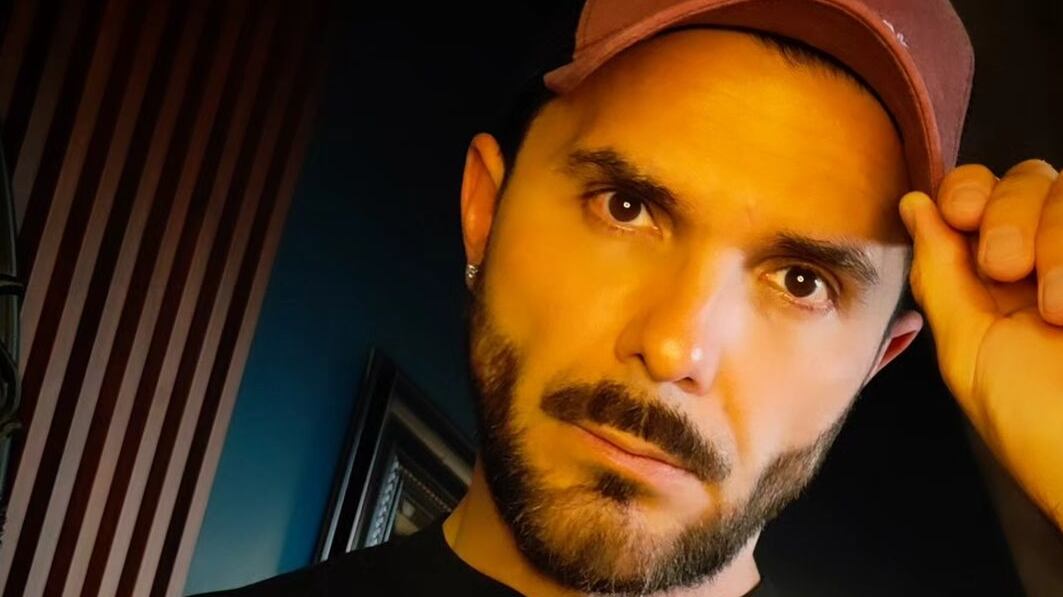 El exchico reality relató las dificultades que padece a diario debido al problema de visión que tiene.