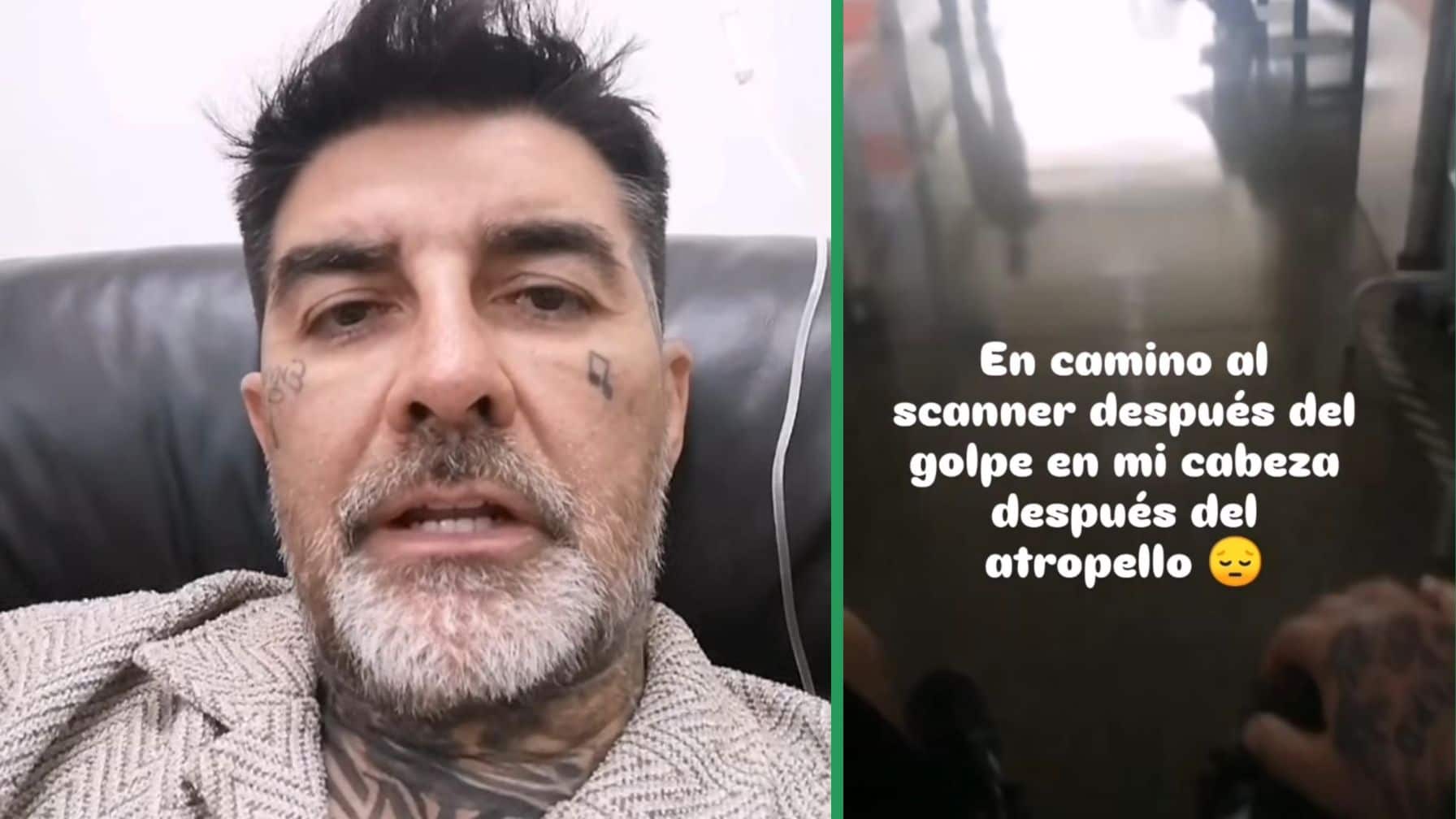 Carabineros constató las irregularidades del conductor tras el accidente, lo que agravó la denuncia presentada por el artista chileno.