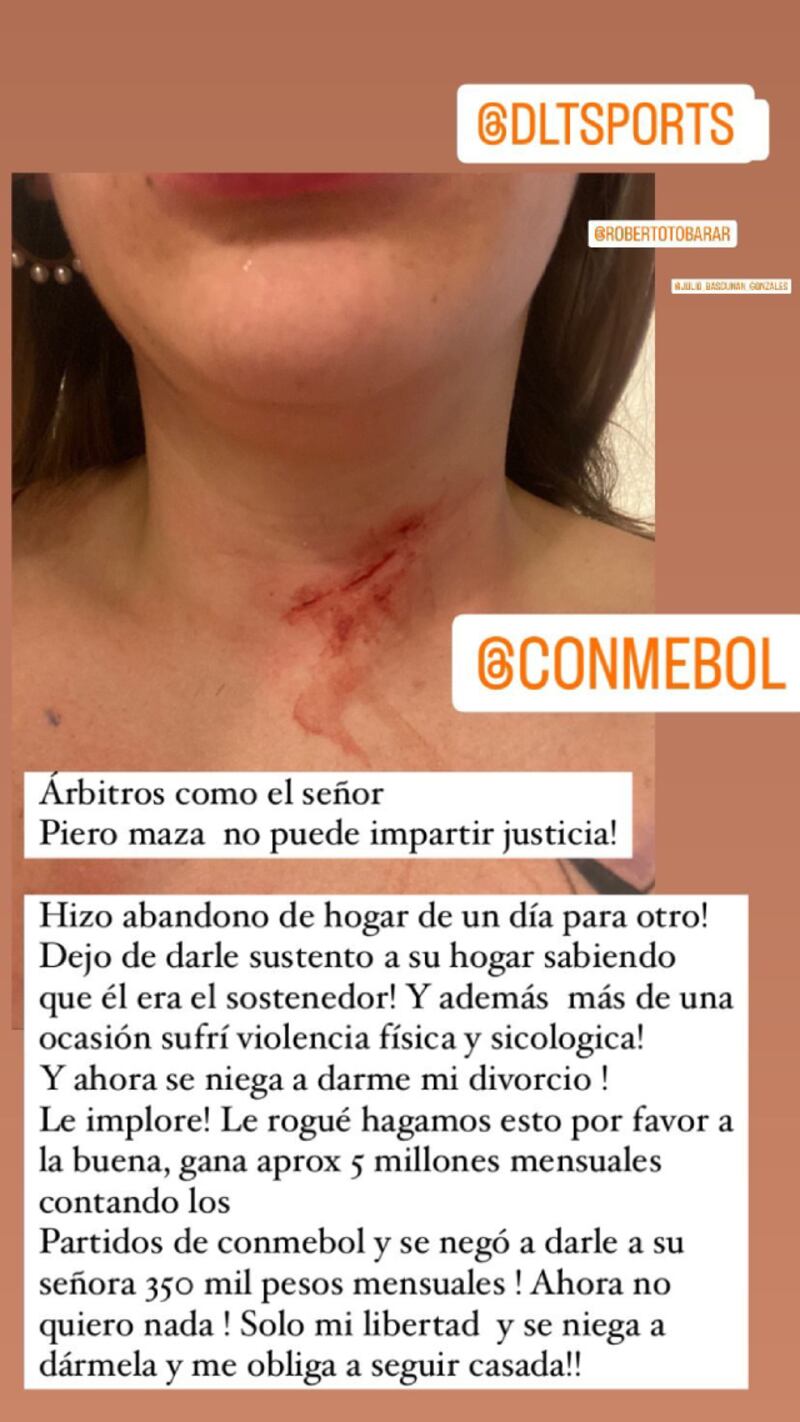 La denuncia de Pollett López contra Piero Maza