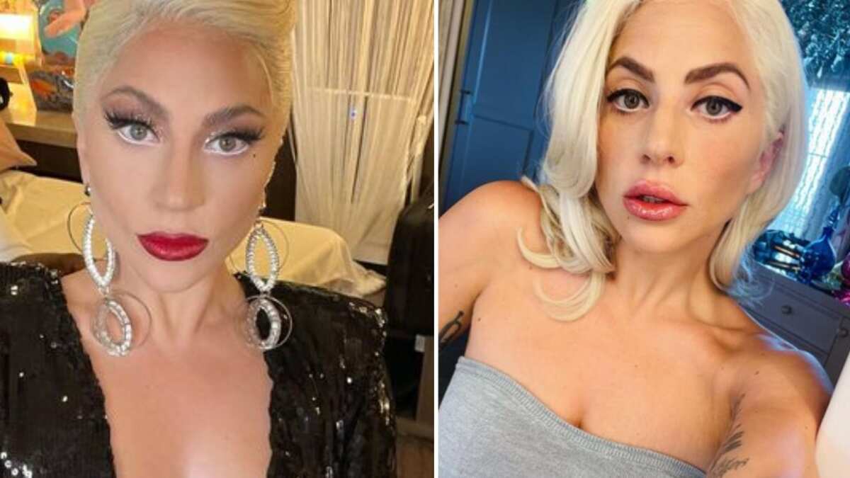 Lady Gaga se muestra sin maquillaje y deja ver su acné y manchas