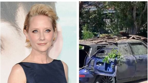 Actriz Anne Heche no sobrevivirá tras su accidente y se le retirará el soporte vital