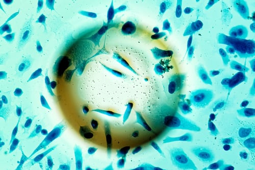 Tecnología nuclear contra el cáncer: El nuevo decreto GES blinda el tratamiento de semillas radiactivas en Chile