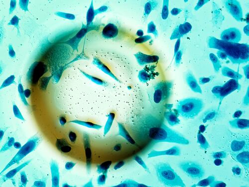 Tecnología nuclear contra el cáncer: El nuevo decreto GES blinda el tratamiento de semillas radiactivas en Chile