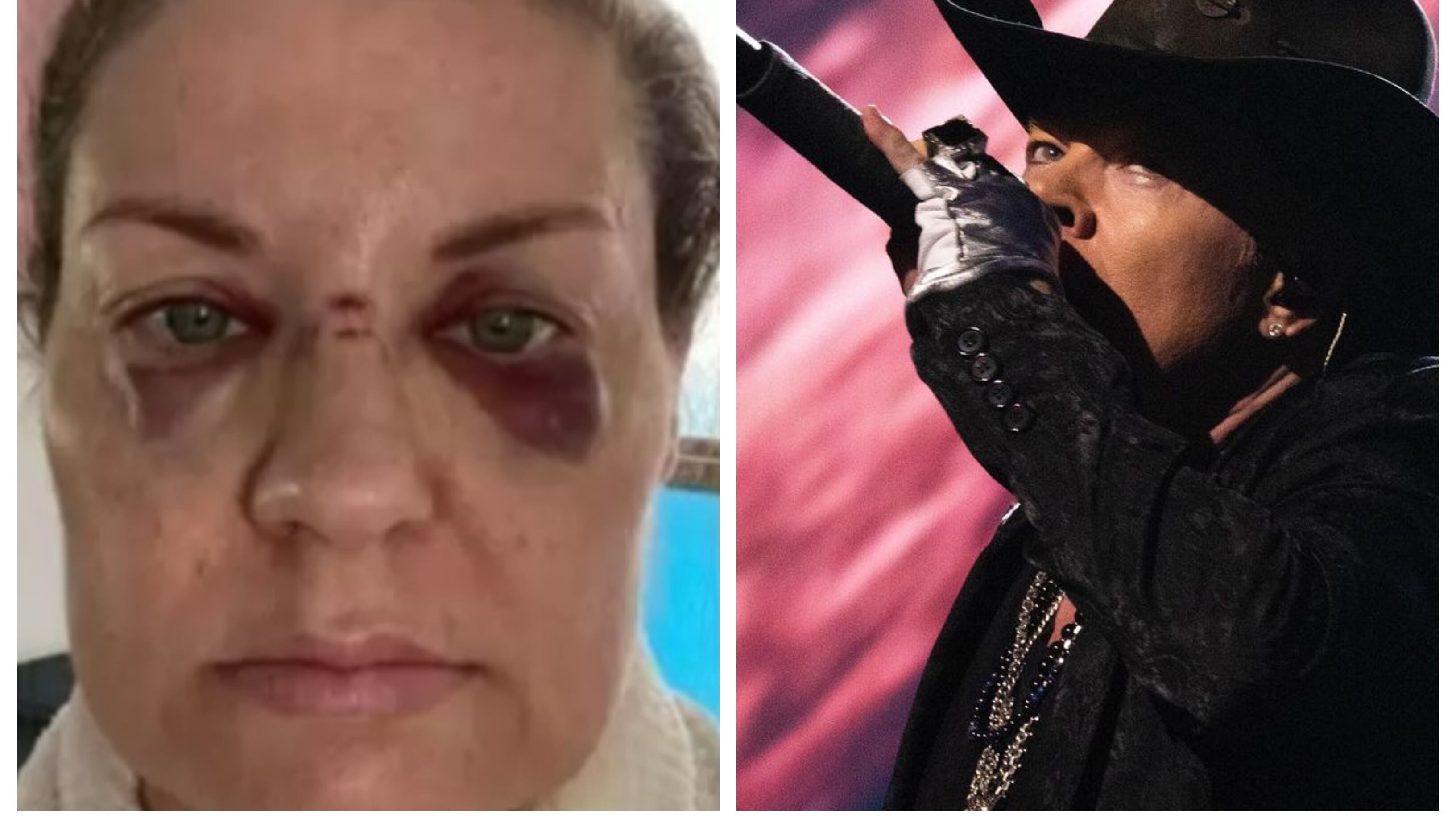 A consecuencia de las lesiones sufridas por Rebecca Howe fue que el vocalista de la banda norteamericana anunció que dejará de lanzar su micrófono al final de los recitales de Guns N' Roses.