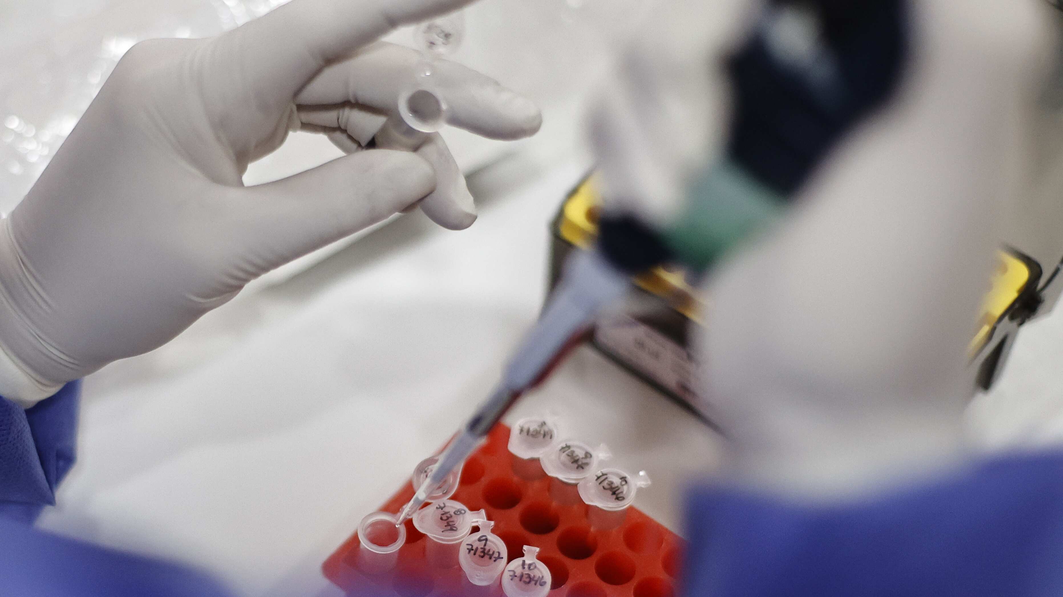 Avances en capacidad diagnóstica de la Viruela Símica en Chile | 30 de mayo 2022/Santiago
El Subsecretario de Salud Pública, Cristóbal Cuadrado, junto al director del ISP, Heriberto García, y la jefa del Departamento Laboratorio Biomédico Nacional y de referencia, Judith Mora, se refieren a los avances en capacidad diagnóstica de la Viruela Símica en Chile.
FOTO KARIN POZO/AGENCIA UNO