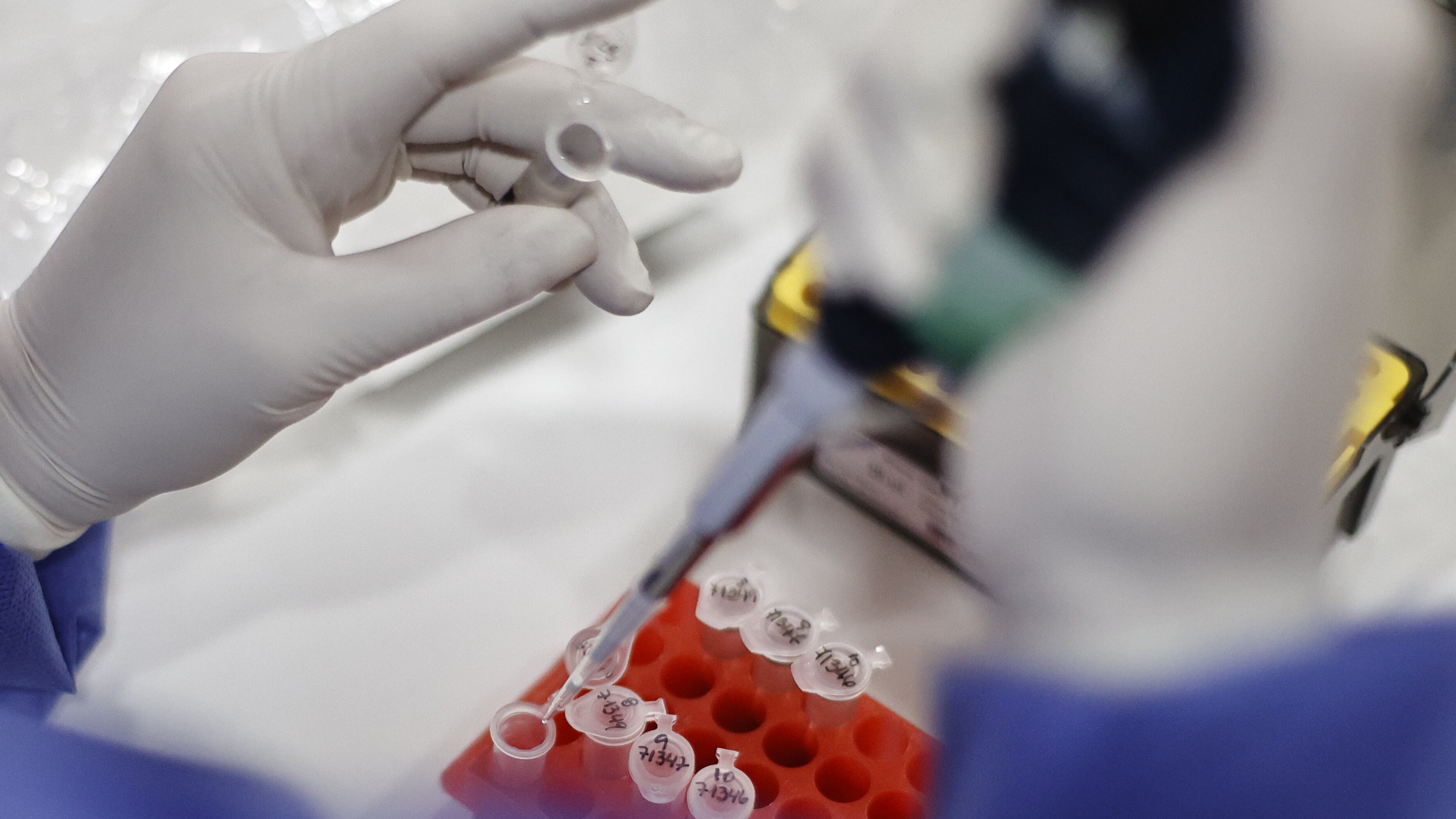 Avances en capacidad diagnóstica de la Viruela Símica en Chile | 30 de mayo 2022/Santiago
El Subsecretario de Salud Pública, Cristóbal Cuadrado, junto al director del ISP, Heriberto García, y la jefa del Departamento Laboratorio Biomédico Nacional y de referencia, Judith Mora, se refieren a los avances en capacidad diagnóstica de la Viruela Símica en Chile.
FOTO KARIN POZO/AGENCIA UNO