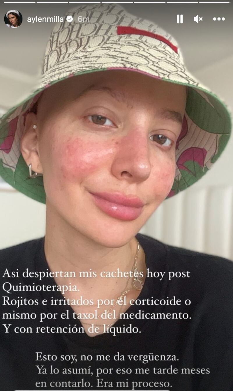 Storie de Aylén Milla