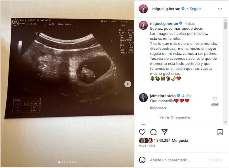 Miguel Herrán está muy emocionado con la llegada de su primer bebé