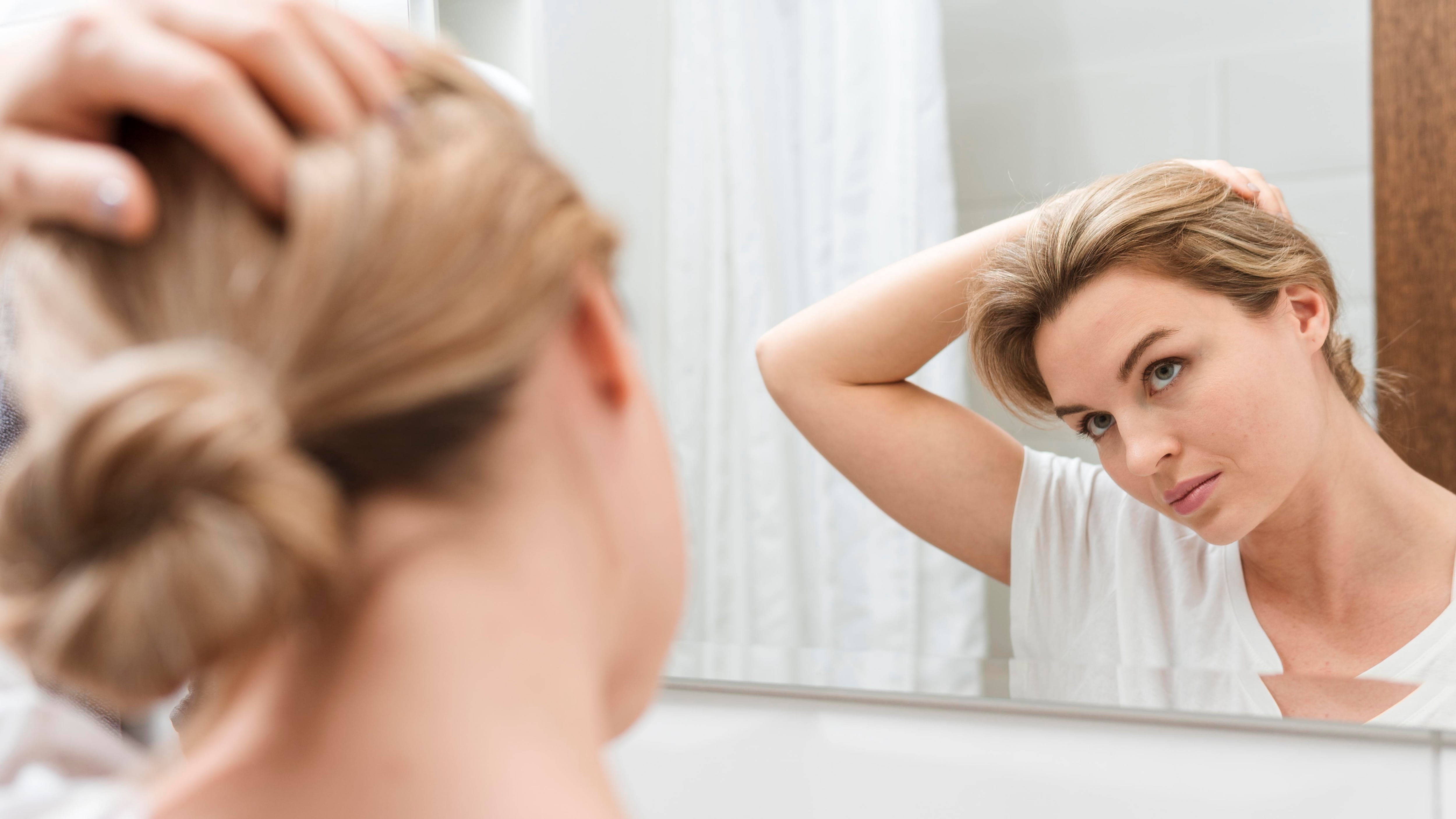 Caída del pelo en mujeres va en aumento