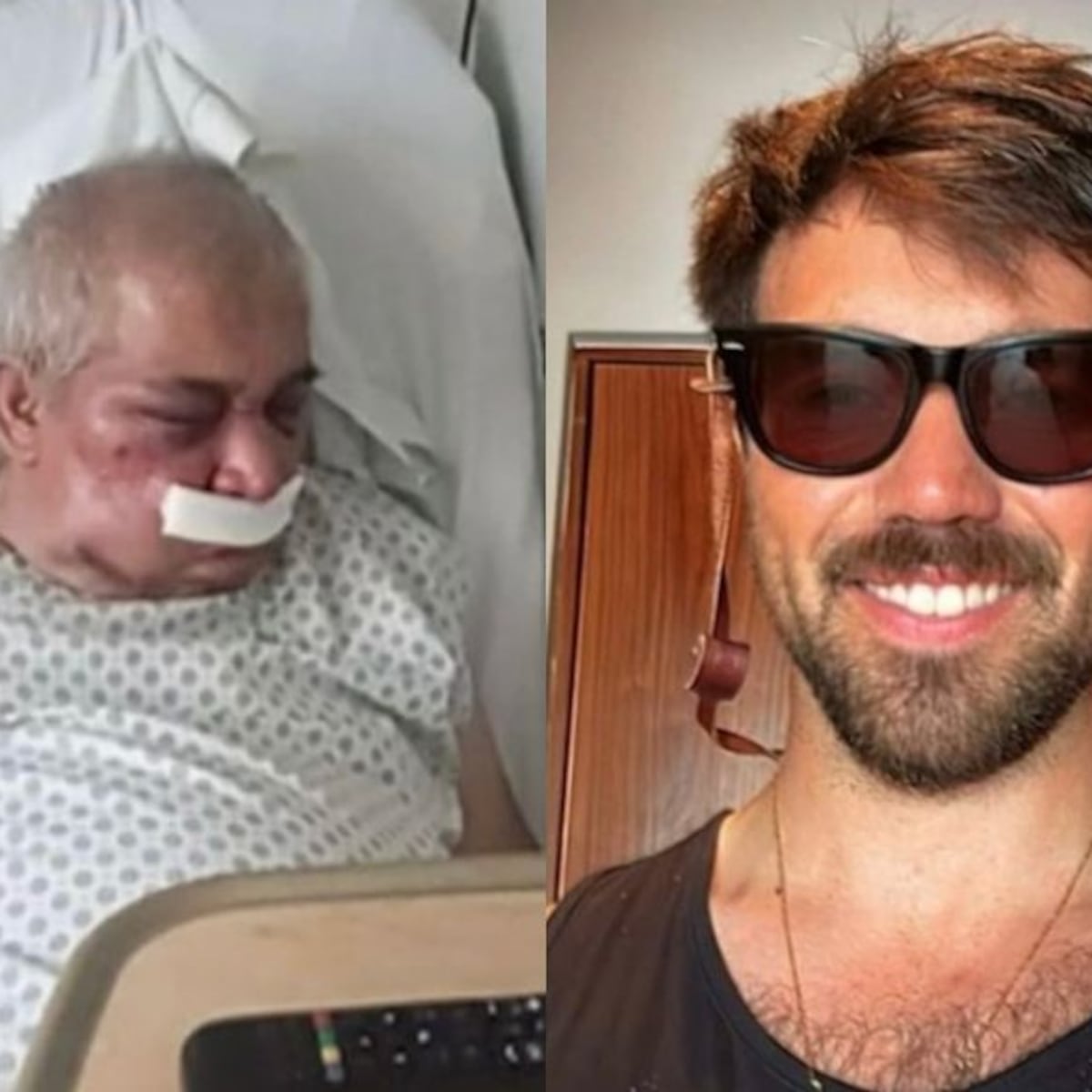 Sujeto imputado por agredir a conserje asegura haber sido agredido Sujeto imputado por agredir a conserje asegura haber sido agredido