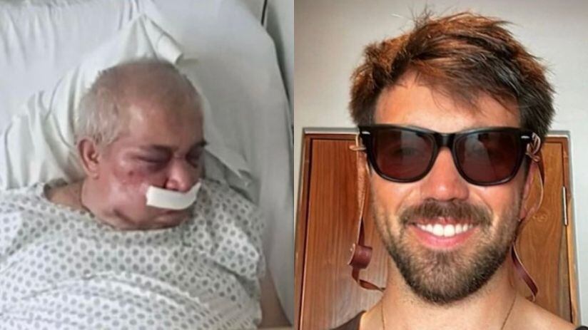 Conserje de 70 años sufrió brutal golpiza en Vitacura: podría perder su ojo derecho