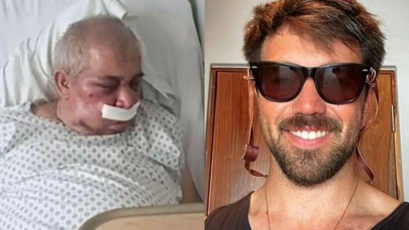 Conserje de 70 años sufrió brutal golpiza en Vitacura: podría perder su ojo derecho