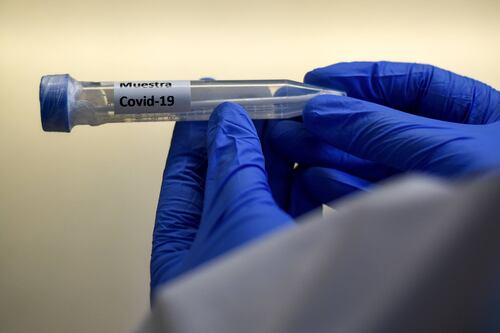 ¿Qué es el Catracho?: el método de Honduras para reducir muertos por coronavirus