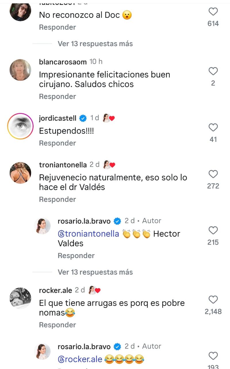 Los comentarios pasaron de “irreconocible” a elogios, destacando un resultado percibido como natural por los seguidores.