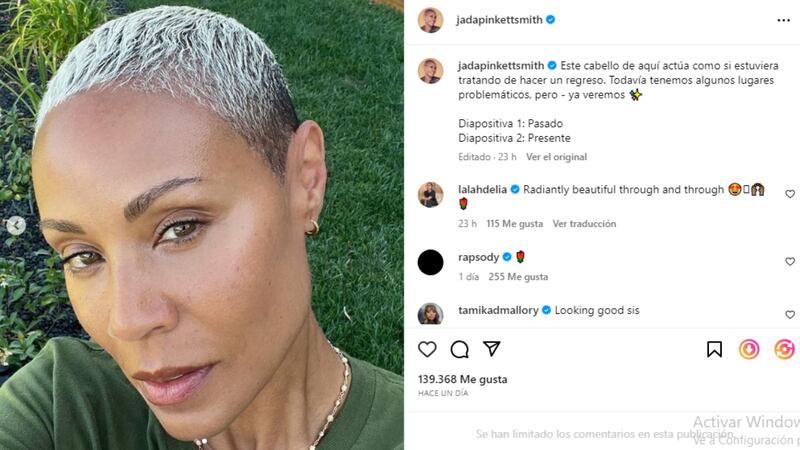 La actriz Jada Pinkett Smith compartió con sus fans los avances  que ha tenido en la batalla contra la alopecia.
