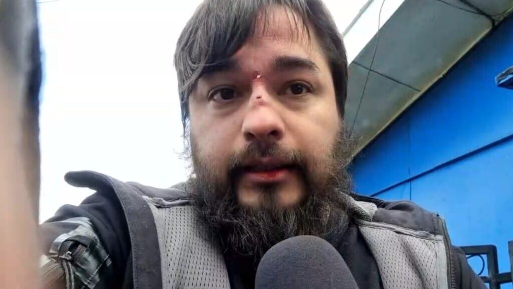 En diálogo con Comunica Aysén, Ángel detalló que “esta persona se levantó, fue corriendo, se tiró donde estaba yo, me empujó y me dio al menos seis golpes en la cara. Traté de cubrirme sin soltar mi equipamiento”.
Junto con confirmar que presentará acciones legales debido a la golpiza, Guerrero aseguró que “es algo que no tiene seguir sucediendo, menos de una persona que trabaja en un ente público como el Serviu”.
