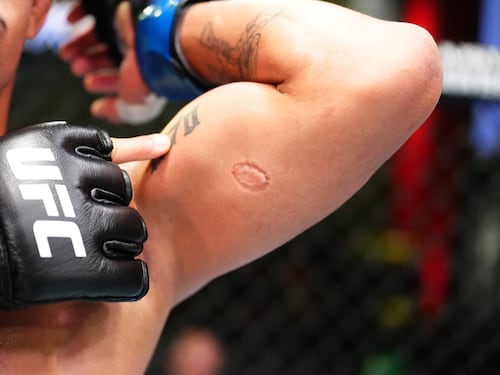 Peleador de UFC gana un bono de 50 mil dólares por mordida de rival