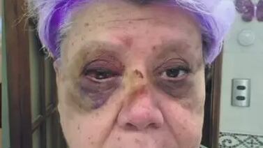 A 110 kilómetros por hora. A esa velocidad Patricia Maldonado dijo que viajaba cuando volcó su vehículo sobre la berma en la Ruta 68. Así lo contó en el programa “Sígueme y te sigo” señalando que fue “como una fuerza superior” que tomó el automóvil y lo zamarreó por los aires.
Según aclaró que sí iba con su cinturón de seguridad y que al momento de la tragedia iba ensayando un monólogo, sin que nada le preocupara en el camino. Por lo tanto, fue todo sorpresivo.
“De repente, no me preguntes qué pasó, no sé qué decirte, no tengo una explicación lógica y racional, siento que el vehículo como que una fuerza superior lo hubiera tomado y estrellado contra la baranda de metal”, consignó La Cuarta.
Respecto a la velocidad que conducía esa mañana rumbo a Santiago, afirmó que “iba como con 110 (Km/h) más o menos. Que es una velocidad normal para mí. Yo me voy todos los días a esa velocidad para allá. 110, 120 (Km/h)”, explicó.
Si bien, la velocidad estaba dentro de los límites, esa mañana el piso estaba resbaladizo, producto de la lluvia lo cual habría originado que perdiera el control del volante.
“Veo que se estrella y no pude controlar el vehículo porque había una tremenda posa de agua y cuando recién empieza a llover la carretera se pone muy jabonosa. Es muy peligrosa”.