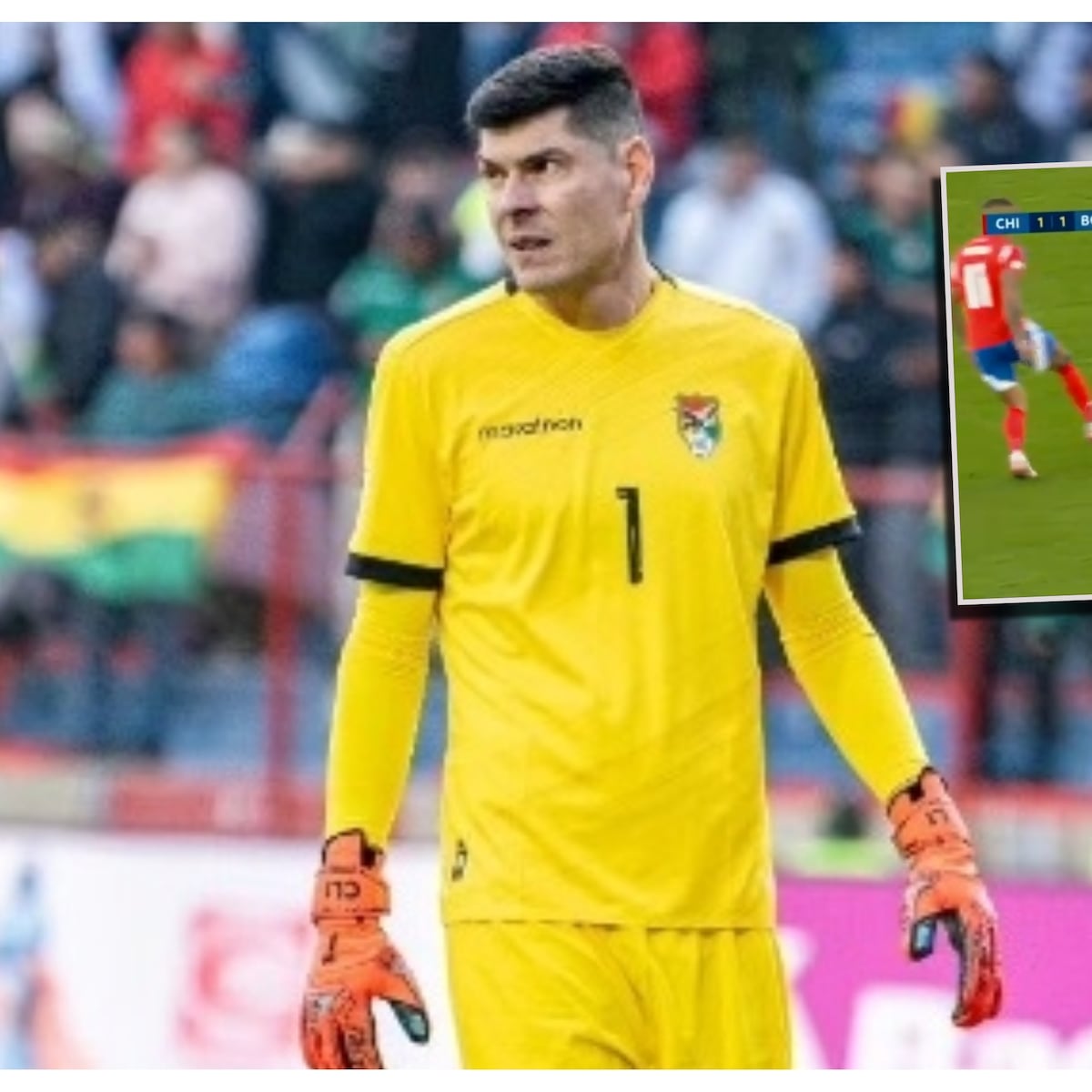 Federación confirma operación de Carlos Lampe en Chile Federación confirma operación de Carlos Lampe en Chile