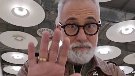 El chef español se intervino de várices.