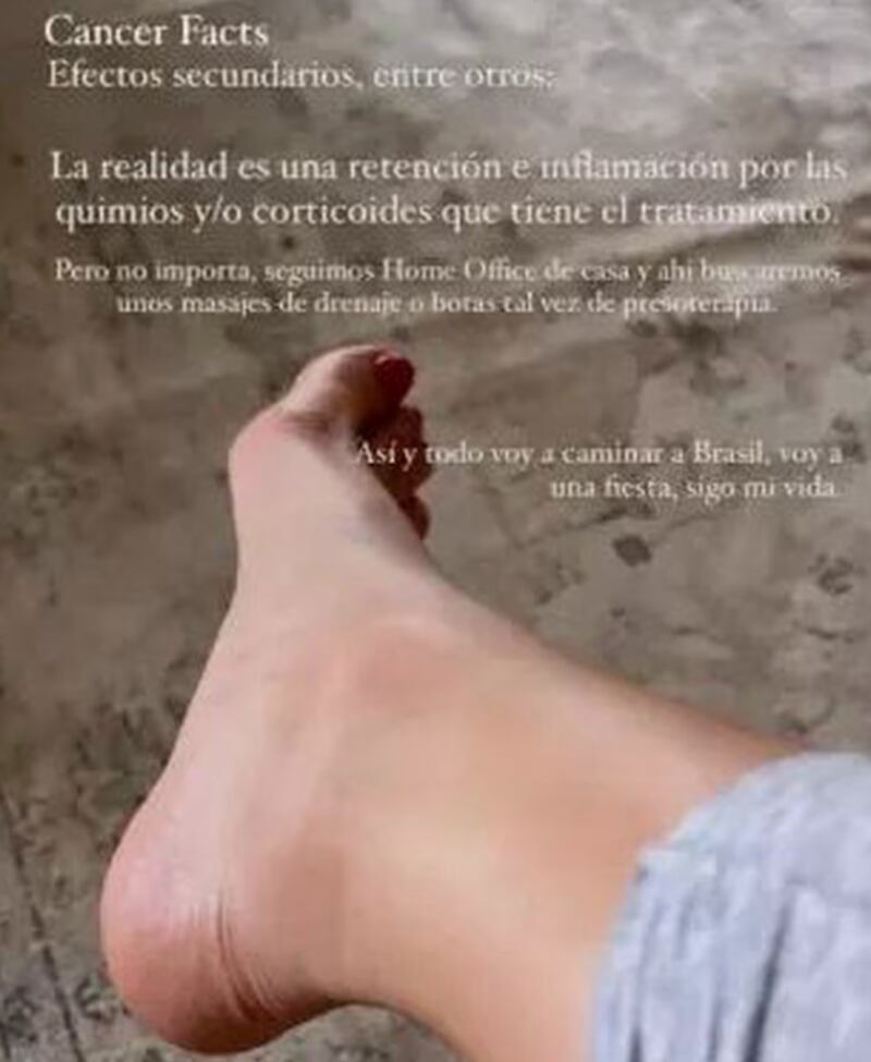 En otra historia, relató los cuidados que debe realizar, los cuales incluyen “mucha vitamina”.
“Mis noches son largas. Piernas arriba, luz roja, mil cremas y procedimientos para cuidarme antes de dormir, muchas vitaminas, productos para que todo se mantenga, crezca, etc”, escribió en la imagen donde se ven sus piernas levantas, y apoyadas contra la pared.
“Desde la uña del pie, hasta la punta de mi cabeza, tengo algo que aplicar para cuidar mi cuerpo de este bombardeo de quimioterapia hacia mis células sanas. Merci mon amour, good nigth vida!”, cerró.
Fue hace una semana que Aylén Milla sinceró en un live que tiene cáncer de mama.
“Soy Aylén, 33 años y tengo cáncer de mama, comportado como triple negativo, agresivo. Llevo 16 quimioterapias. Esta es mi historia”, escribió la argentina en el post, junto a la transmisión donde confesó a sus seguidores la compleja situación de salud que atraviesa desde noviembre del 2022.