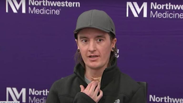 Joven perdió sus pulmones por fumar vape, pero se salvó gracias a implantes mamarios