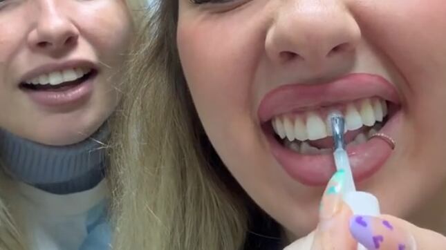 Influencer desata polémica con su truco para blanquear los dientes.