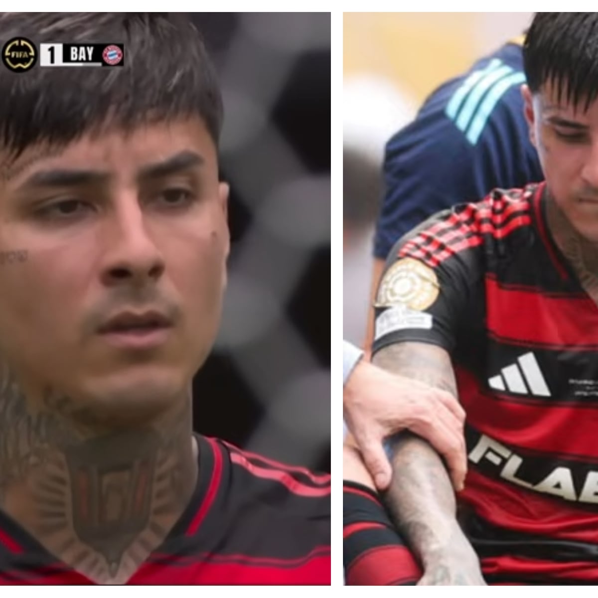Lesión de Erick Pulgar en Mundial de Clubes: fuera varios meses Lesión de Erick Pulgar en Mundial de Clubes: fuera varios meses