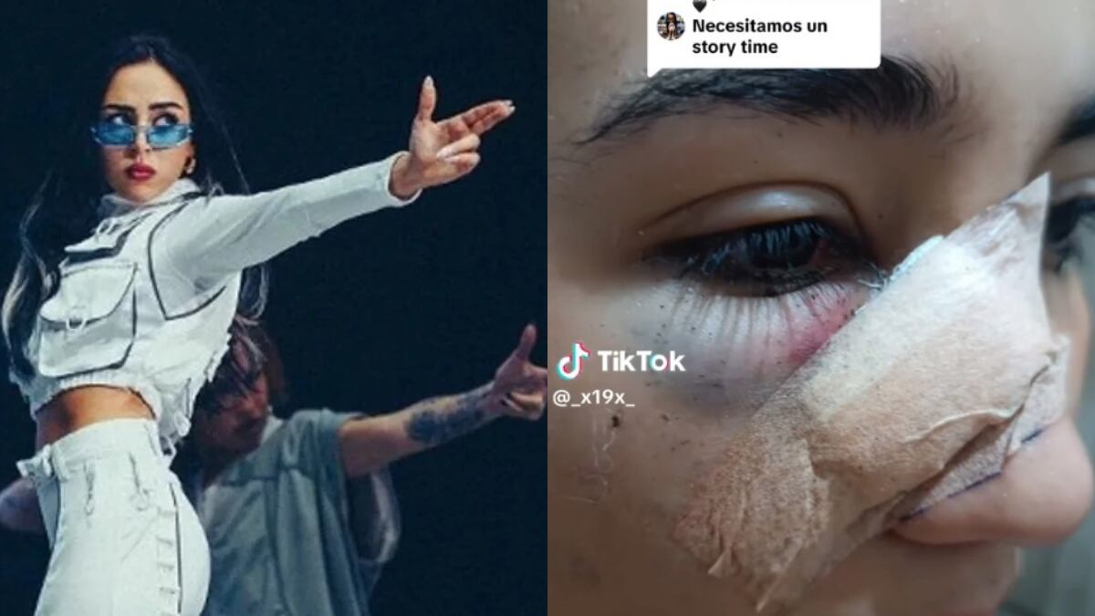 Fan de Nicki Nicole con el botellazo