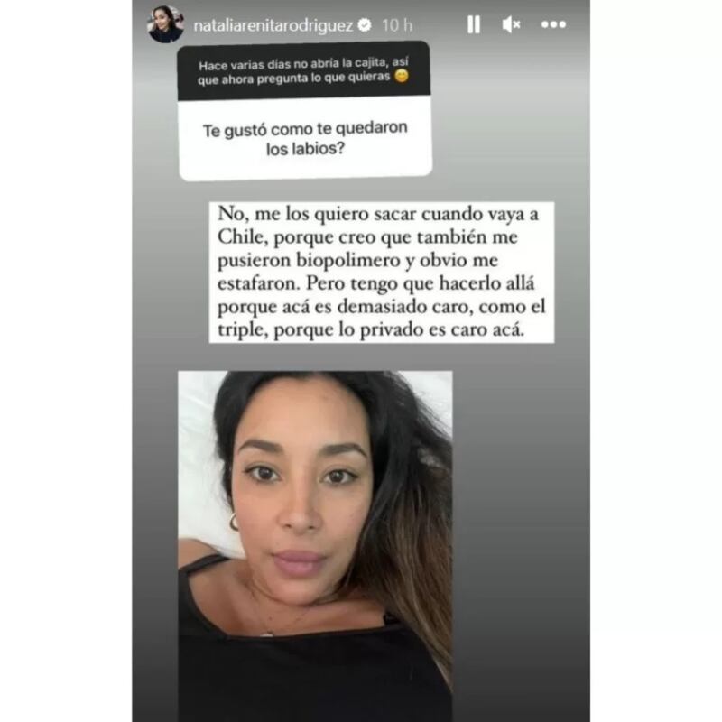 La idea era lucir espléndida, pero el resultado no fue el esperado. Así lo reveló Natalia Rodríguez en su cuenta de Instagram, cuando le consultaron sobre el resultado de sus labios, tras inyectarse, supuestamente, ácido hialurónico para aumentar su tamaño.
Fue en las dinámicas de preguntas y respuestas, cuando una seguidora le preguntó si había quedado conforme, recibiendo una rotunda respuesta.