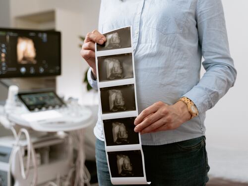 Congelación de óvulos: una opción para postergar la maternidad