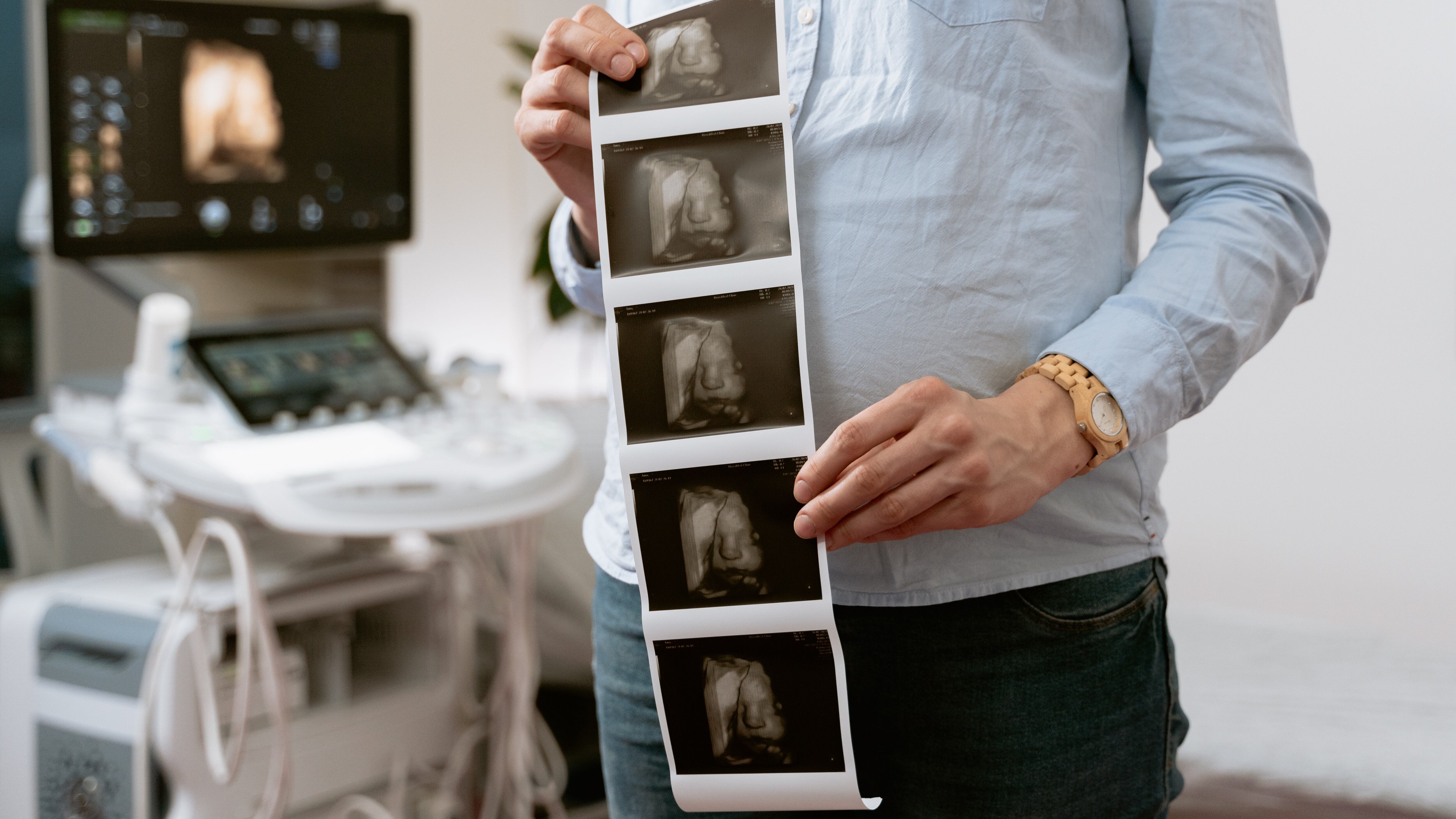 Mujer en período de gestación. Foto: Pexels