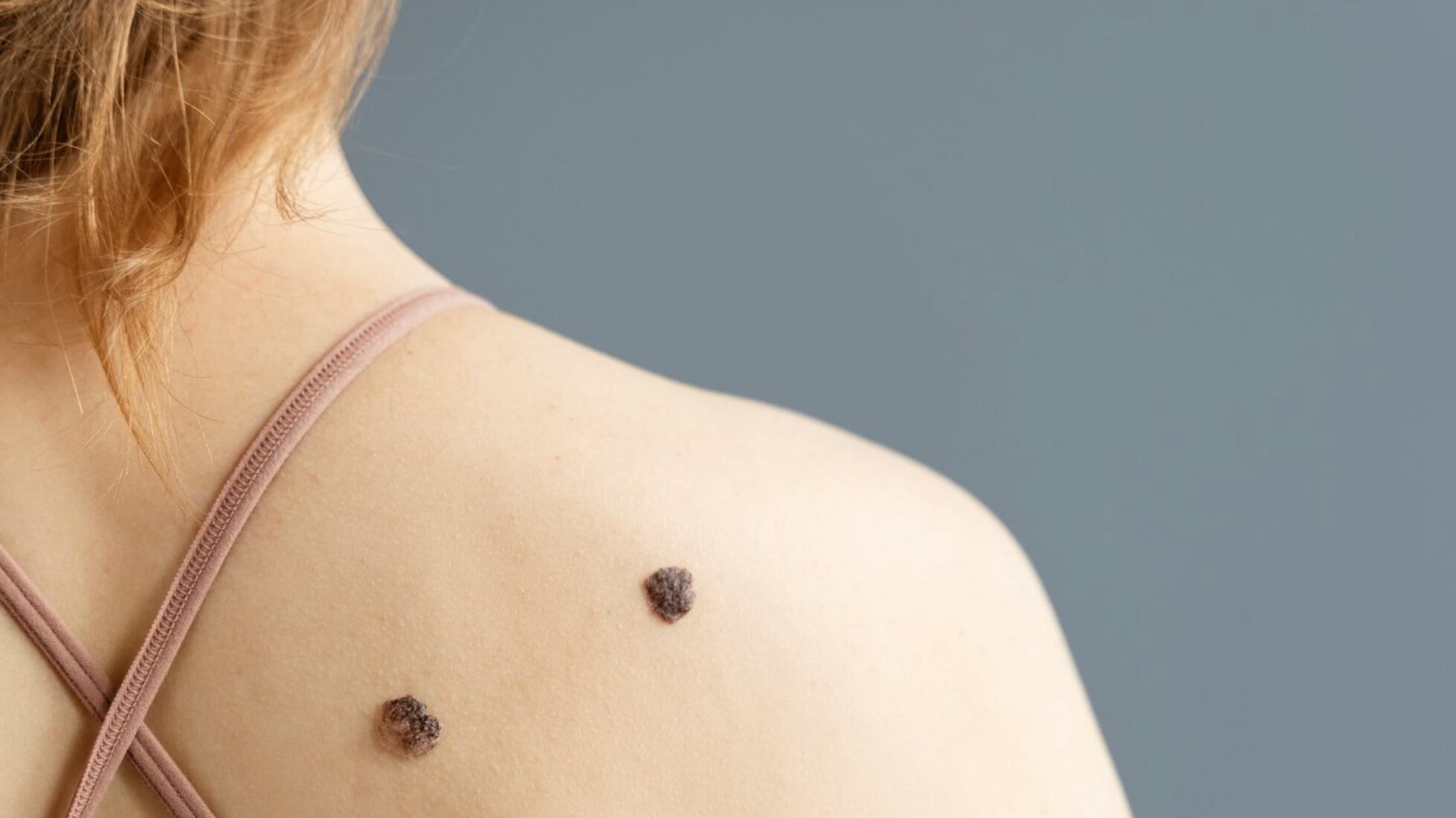 Hay ciertos síntomas de cuidado